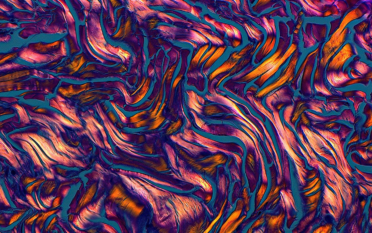 ziad_zaatari's tweet photo. 🔬📸 Collagen Fibers under Polarized Light ~ #Pathology #Histology #SciArt #BioArt #Microscope #PathArt 🎨 https://t.co/wnO8Px6BkJ