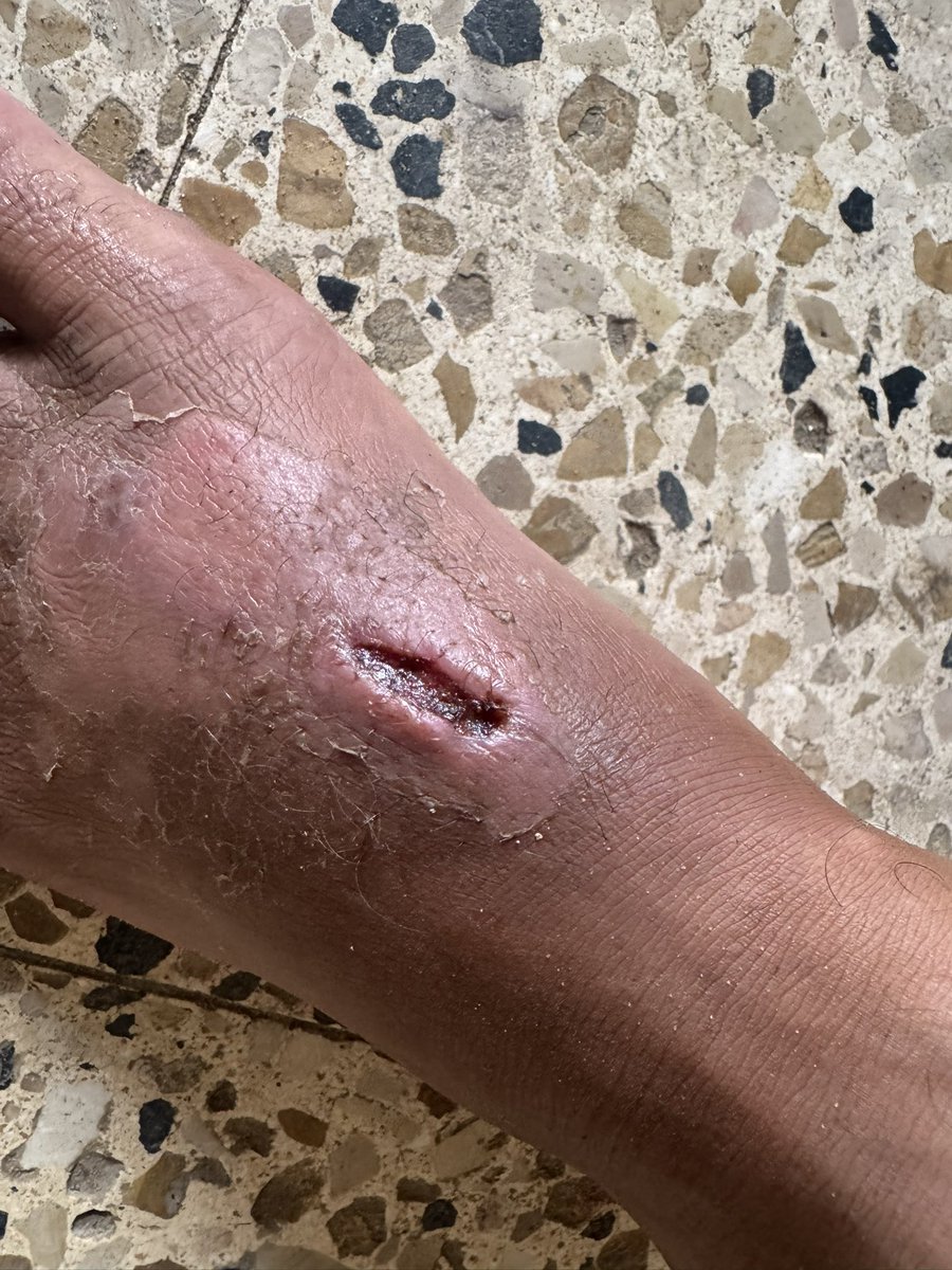 Humanity check 😭

︎
︎

︎
I NEED MEDICINE 💊
︎

︎

︎
︎

︎

︎

︎i’ll remind u🥹
︎

︎

︎

︎

︎
︎

︎
say hi

︎
︎

︎
︎

︎

︎

︎

︎
I NEED MEDICINE FOR MY WOUND 💊🩹

If you’re scrolling, PLEASE leave a dot . it’s just a dot

gofund.me/d81fe6e6d