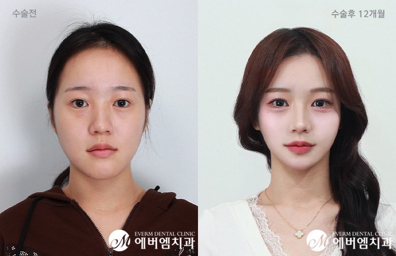 なえ🌱 tweet media