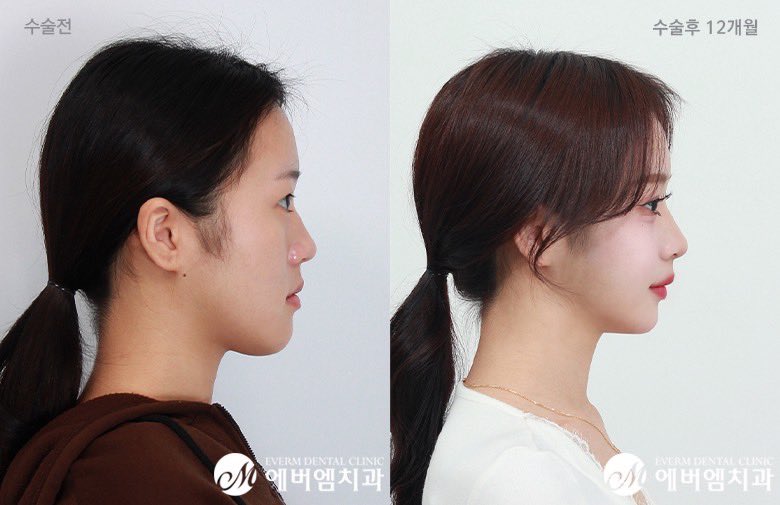 なえ🌱 tweet media