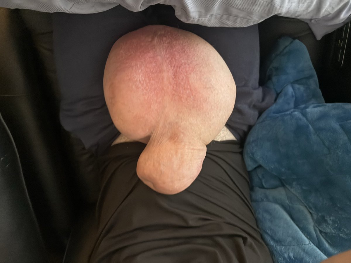 <a href="/ter_ff_boyfist/">K"ฉีด 70 ++ Ter</a>