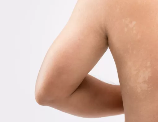 Rapma FM tweet media