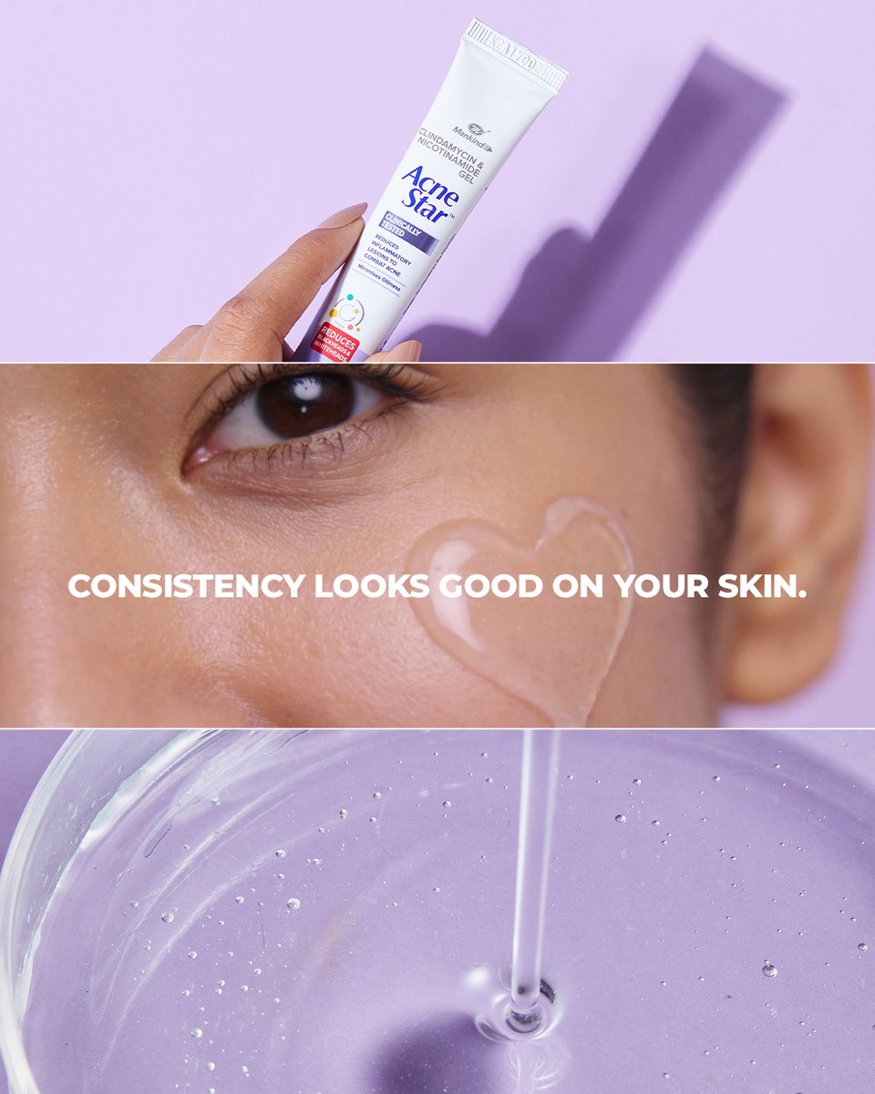 AcnestarGel's tweet image. The best care feels comforting, not complicated. AcneStar supports your skin daily, keeping it calm, clear, and at ease.

#AcneStar #ComfortingCare #DailySkincare #GentleSkincare #CalmClearSkin #AcneCareRoutine #SkinAtEase #SoothingSkincare #HealthySkinDaily #SimpleSkincare
