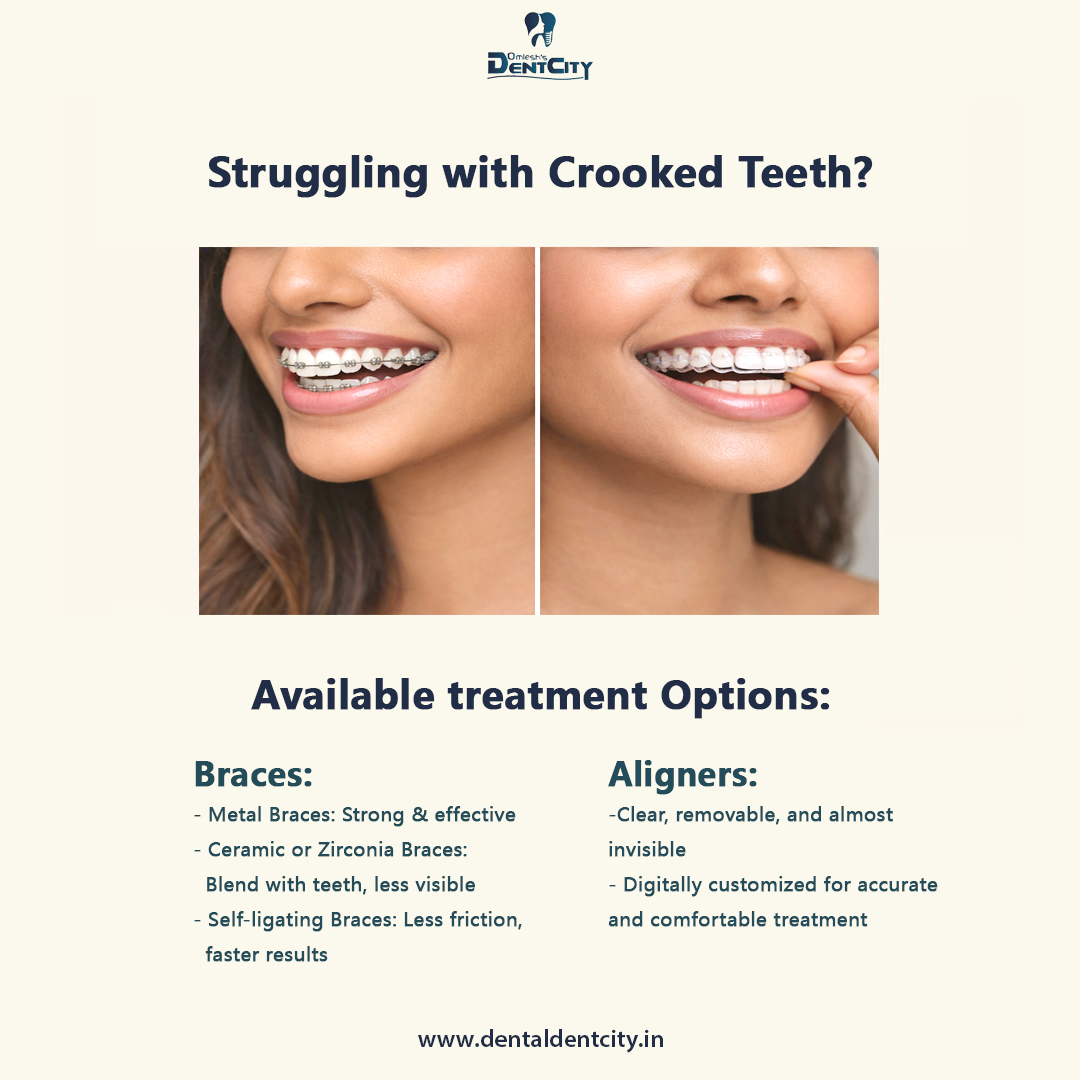 omleshsdentcity's tweet image. Crooked teeth aren’t just cosmetic—they affect your bite and oral health.
At Omlesh’s Dentcity, get personalised braces &amp;amp; clear aligner solutions for a confident smile. 🦷
📞 89208 76684
#CrookedTeeth #TeethAlignment #ClearAligners #BracesTreatment  #OmleshsDentcity