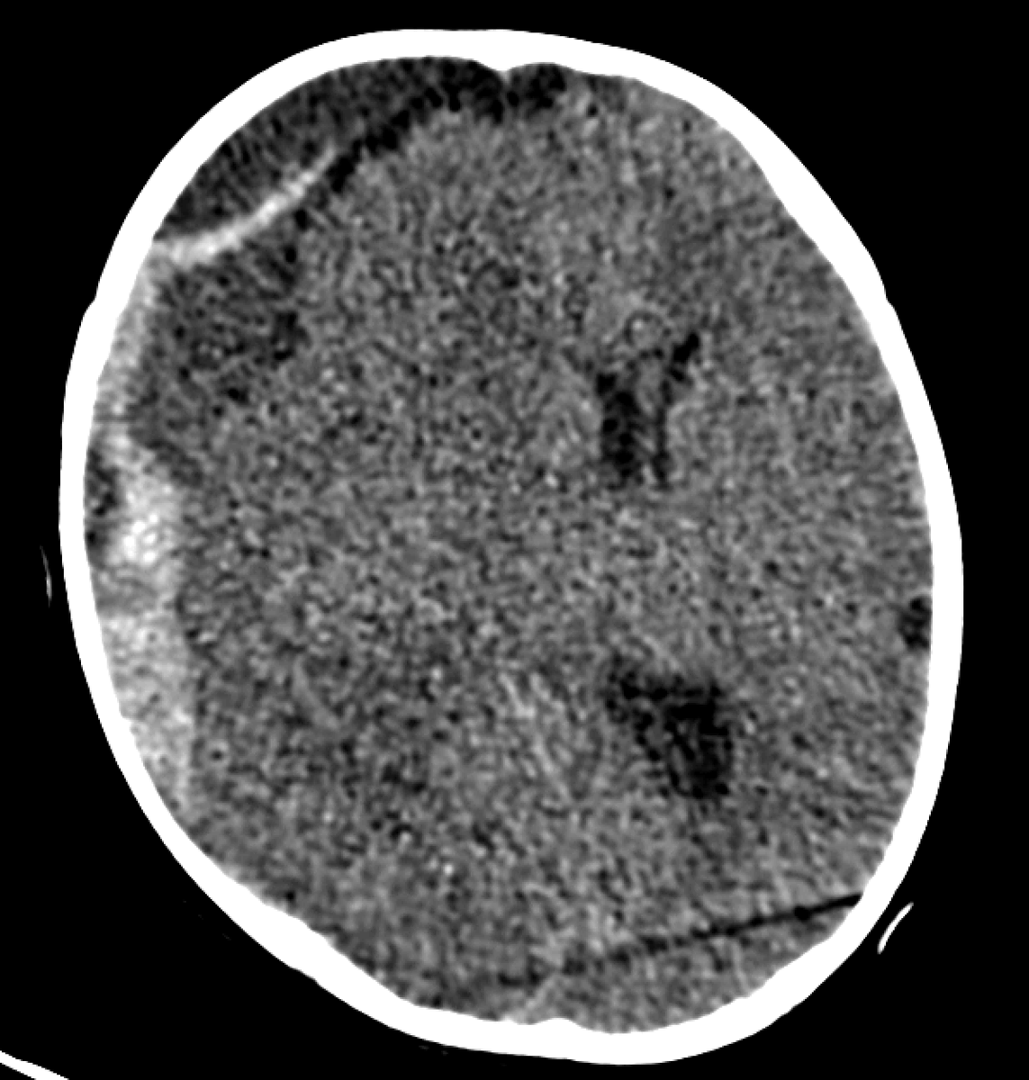 Jack Garnham tweet media