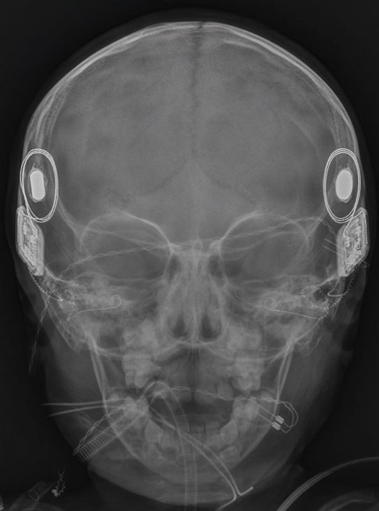 رضا الرميح tweet media