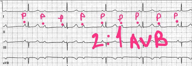 112Ferdi (@frdbjk112) on Twitter photo 