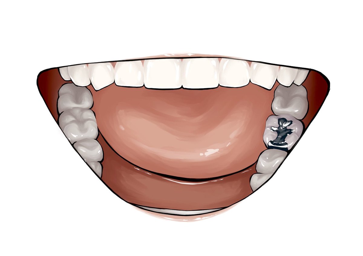 tsugikomu's tweet image. 悪い歯たち