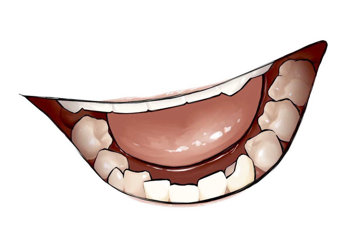 tsugikomu's tweet image. 悪い歯たち