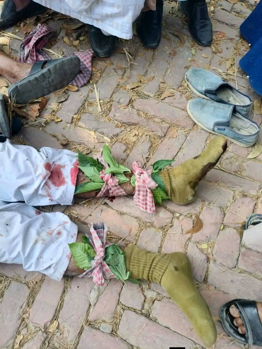 knabilbd's tweet photo. Supporters of #BNP candidate Nurul Islam Moni are allegedly repeatedly attacking campaign workers of #Jamaat-nominee Dr. Sultan Ahmed, the 11-party alliance candidate in #Barguna-2, raising serious concerns about #election violence. #Bangladesh 
#Election2026 @ijabs @AJEnglish https://t.co/krdgTLBgxi
