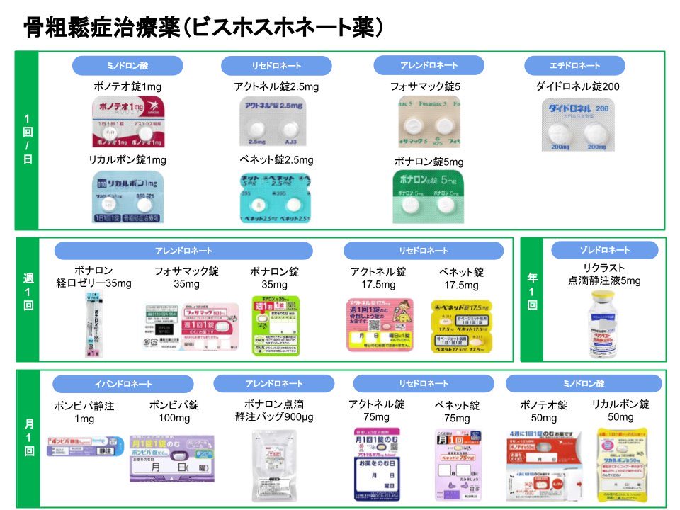 ___7sim's tweet image. 潰瘍性大腸炎治療でステロイドを使用した方、骨粗鬆症の予防薬は一緒に処方されましたか？ビスホスホネート薬を飲まれた方はいますか？共有したいです。
私は処方なしでしたが、骨密度が低下していて今からでも飲みたいなと。(骨貯金)ガイドラインには当てはまるけど、処方されてない人の方が多そう？