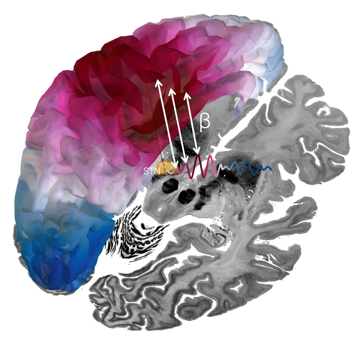 Brain (@Brain1878) / Posts / X