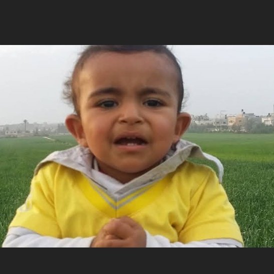 HasanAllail1's tweet image. Ali Abu Al-Lail has a hole in his heart and needs urgent surgery abroad. Medical reports are available.📄
He dreams of traveling for treatment. Please help us save his life! ✈️
#SaveAli #HeartSurgery #URGENTE 
@WHO @ICRC 
@azaizamotaz92 
@DrLoupis__ 
gofund.me/1d2ddd8cc