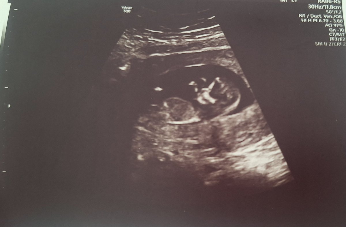 |فاطمه صفری| tweet media