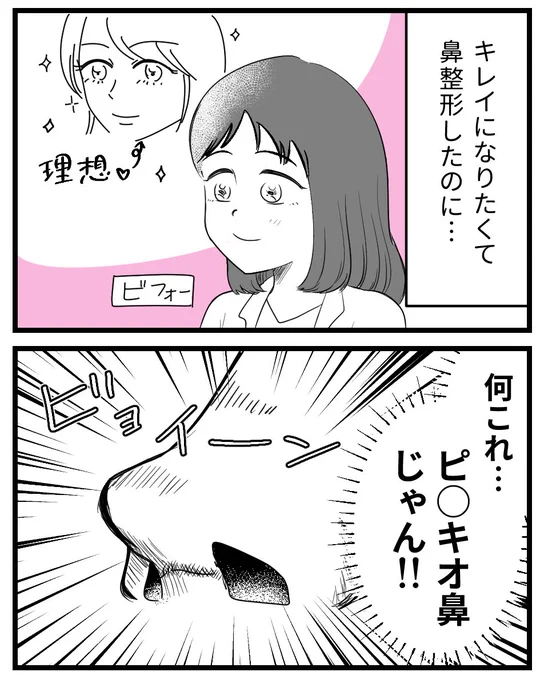 鼻整形したらピノ◯オ鼻にされた話(0/4) 