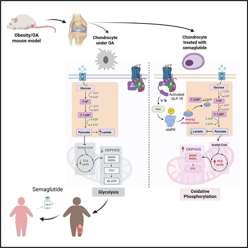 🦵La semaglutida mejora la progresión de la osteoartritis a través de un mecanismo de restauración metabólica independiente de la pérdida de peso. #GLP1

📌La semaglutida alivia la OA de forma independiente de la pérdida de peso.
📌La semaglutida cambia el metabolismo de los
