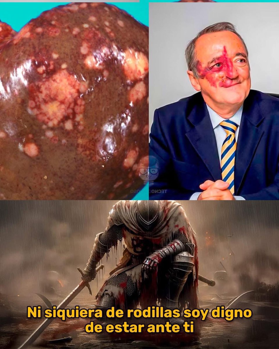 ÉL NO CAMBIÓ SU CARA. CAMBIÓ LA HISTORIA📚🔥

Mariano Barbacid es uno de los científicos más importantes del mundo y aun así muchos decidieron fijarse en lo superficial. 🧠⚡

Lideró investigaciones que lograron frenar el cáncer de páncreas en laboratorio, uno de los tumores más