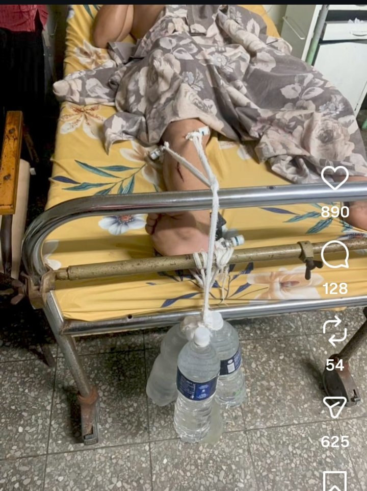 “Resistencia creativa”: sogas y botellas de agua para sujetar a un enfermo.
Para el pueblo, hospitales en ruinas.
Para los dirigentes, clínicas de lujo.
No es bloqueo: es abandono criminal.