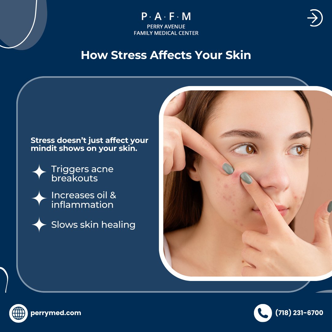 PerryMed18's tweet image. Stress can trigger acne, inflammation, and early aging but you can take control. 

Manage stress, follow a proper skincare routine, and get expert dermatology care for healthier skin. Start today: perrymed.com/services/derma…

#ClearSkinGoals #HealthySkin #PerryMed