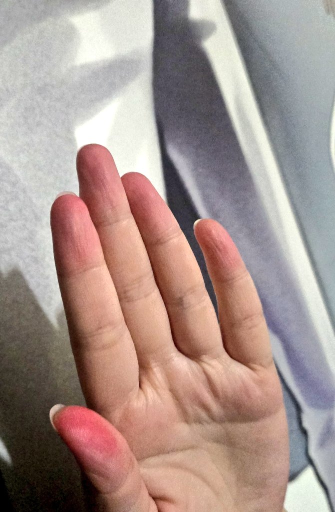 오늘 머랭쿠키 굽고 설거지 하다가 손 끝이 핑크. 됨