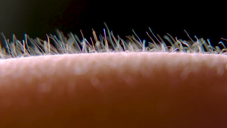 Y dijo Herodes ; La semana que viene empieza la Cuaresma miarma toa.