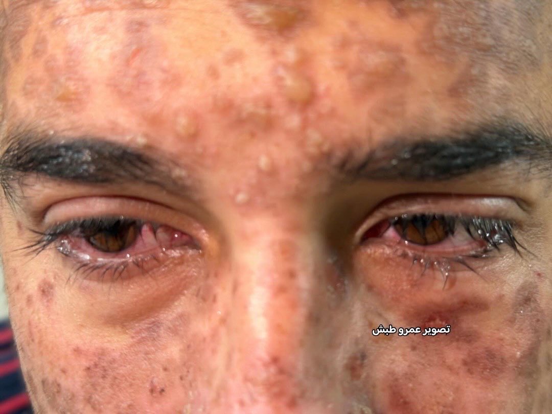 Eye on Palestine tweet media