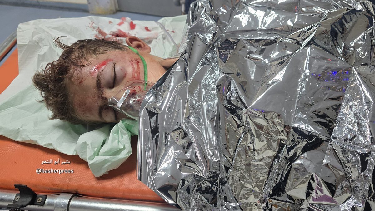 Breaking: 11-year-old Malek Obeid was shot by Israeli forces on Al-Nuzha Street in Jabalia al-Balad, north of Gaza City. He is now fighting for his life.