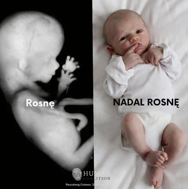 CitizenGO_PL's tweet image. #ProLife