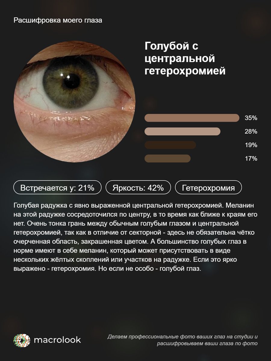 LeyaLal's tweet photo. https://t.co/GBHausk4B7
Правый и левый глаз) https://t.co/nXSU5glXPi