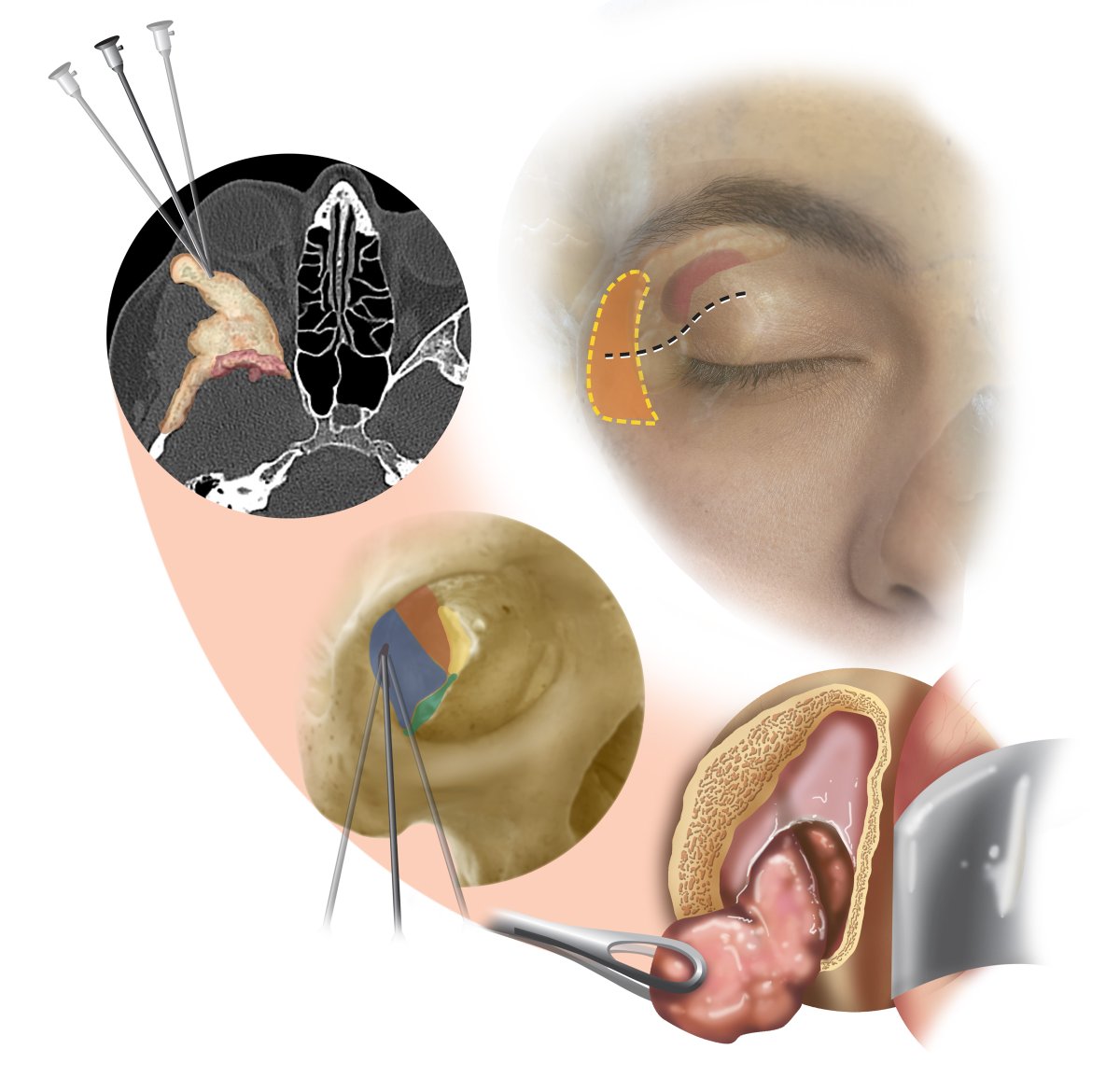 Penn Neurosurgery tweet media