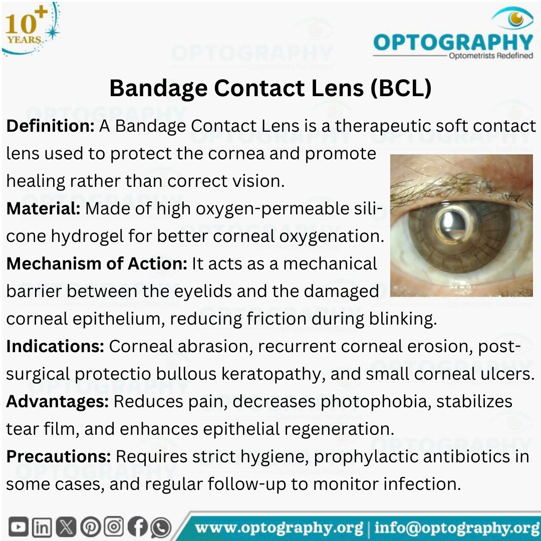 Optography8's tweet image. Healing begins with protection 👁️

Bandage Contact Lens – shielding the cornea, reducing pain, and promoting faster epithelial recovery.

#ClinicalOptometry #CornealCare #TherapeuticLens #Optometry #Optography #Thatoptometrist