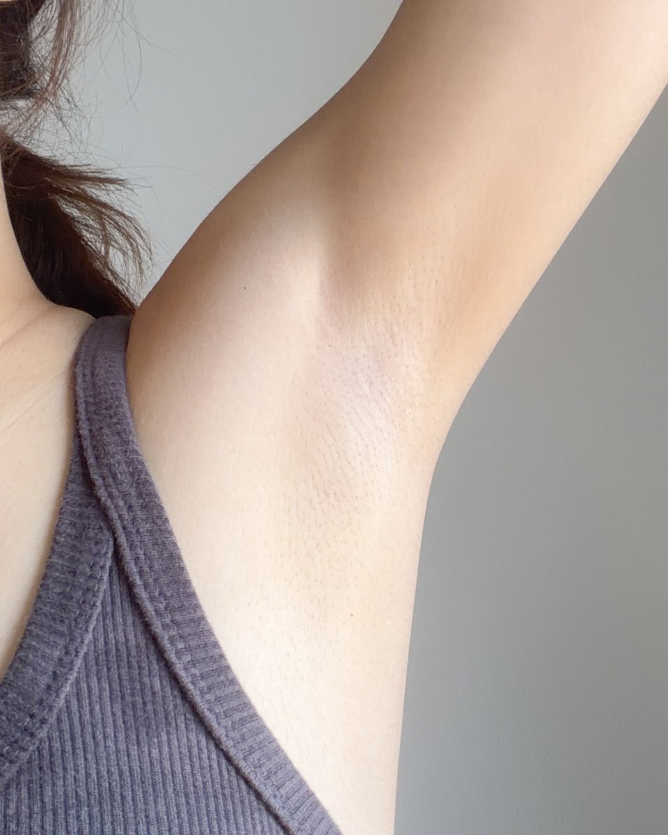 วีคหนึ่งแนะนำว่าเราควรสครับรักแร้ 1-2 ครั้ง/สัปดาห์ ช่วยผลัดเซลล์ผิวเก่า รักแร้จะดูเนียนใสขึ้น นี่ทำเป็นประจำเลย คือรักแร้ใสขึ้นจริง