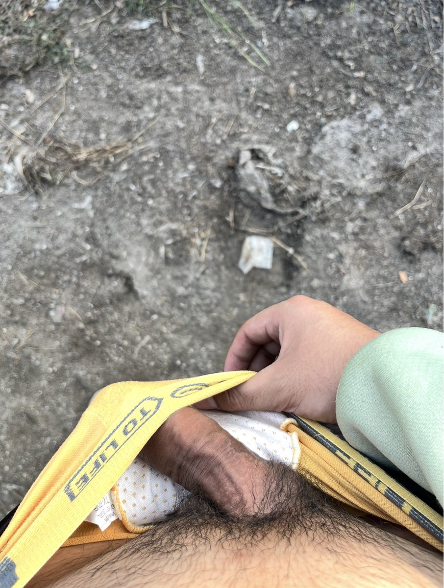 OD 🍍💦 tweet media