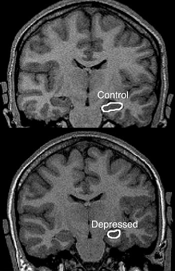 LUKEY ✣ tweet media