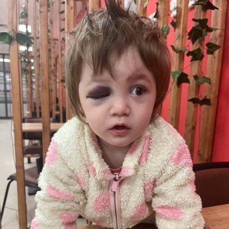 14 aylık bir bebeği şu hale getiren hırtlar ile ben bu ülkede beraber yaşamak istemiyorum