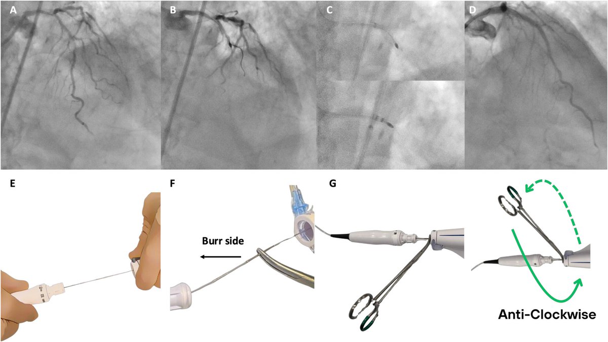 Giuseppe Biondi-Zoccai tweet media