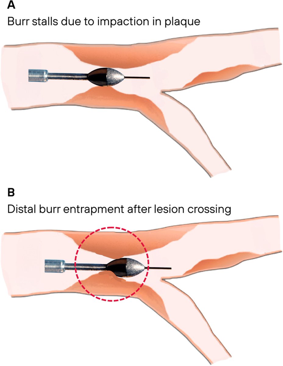 Giuseppe Biondi-Zoccai tweet media