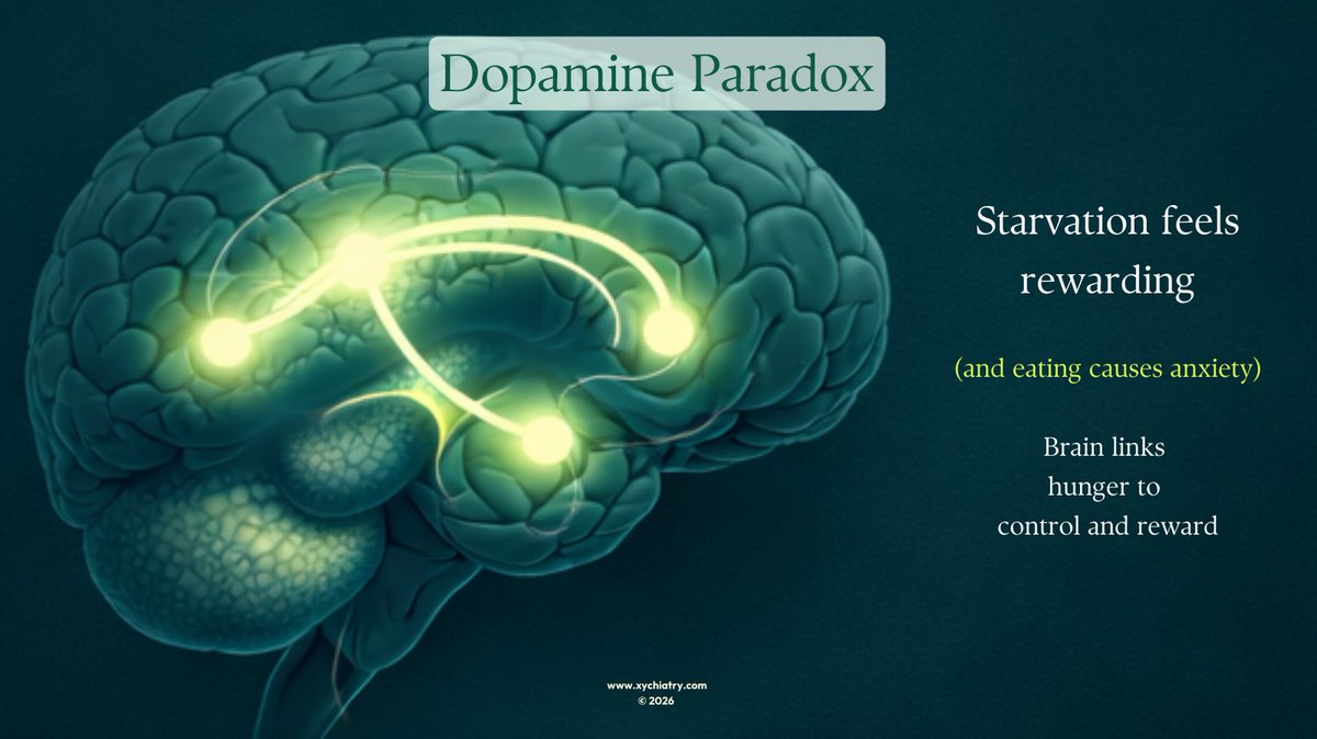 xychiatry's tweet photo. Anorexia isn’t about vanity. It’s a neurobiological disorder.

Starvation alters reward circuits, distorts body signals, and rewires fear responses.

During #EDAW2026, move beyond stigma. Understand the brain.

#AnorexiaNervosa #EatingDisorders #Neurobiology #XYCHIATRY https://t.co/F6d4mStYJF