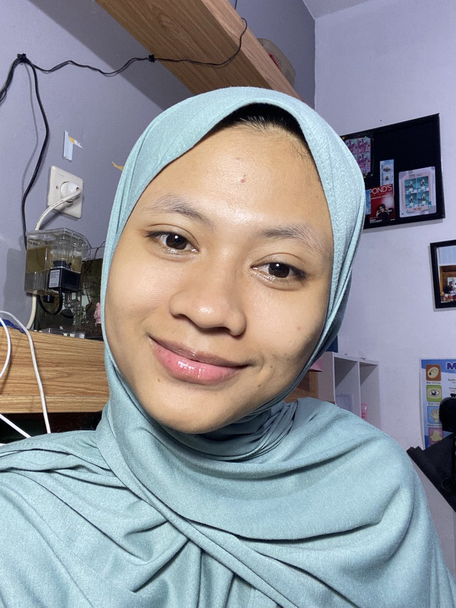 reevyha's tweet photo. kulit lbh bersih &amp; siap lnjut skincare.
Buat yang cari cleanser aman dipakai tiap hari, ini worth to try.
🛒 COSRX Low pH Good Morning Gel Cleanser : #COSRXIndonesia #TemanCOSRX #KoreanSkincare 
Available di Shopee https://t.co/v21IdyTHYF 
before:                          after https://t.co/WF8D0GC9pG