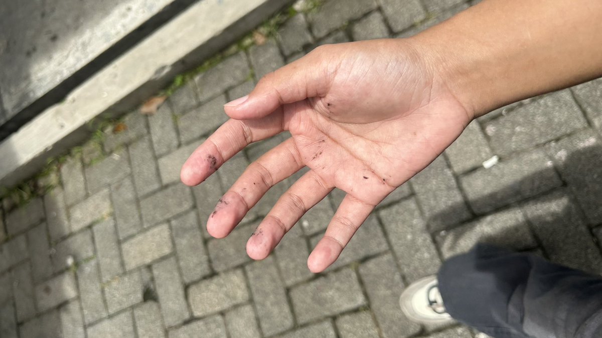 Haa siapa yg doain gw diberakin burung doanya udh terkabul gw minta maaf kl ada slh next time doanya kesandung aja tlg 😭