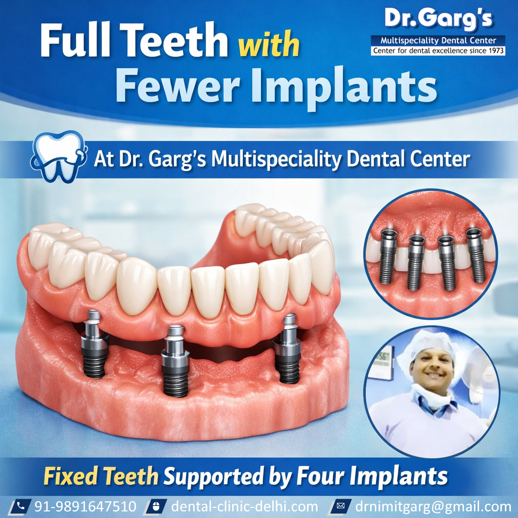 ✨ Full Teeth with Fewer Implants – Fixed Teeth Supported by Four Implants

Dr. Garg’s Multispeciality Dental Center.
Get permanent, natural-looking teeth with fewer implants and long-lasting results.

📞 9891647510
🌐 dental-clinic-delhi.com

#DrGargsDentalCenter #Dental