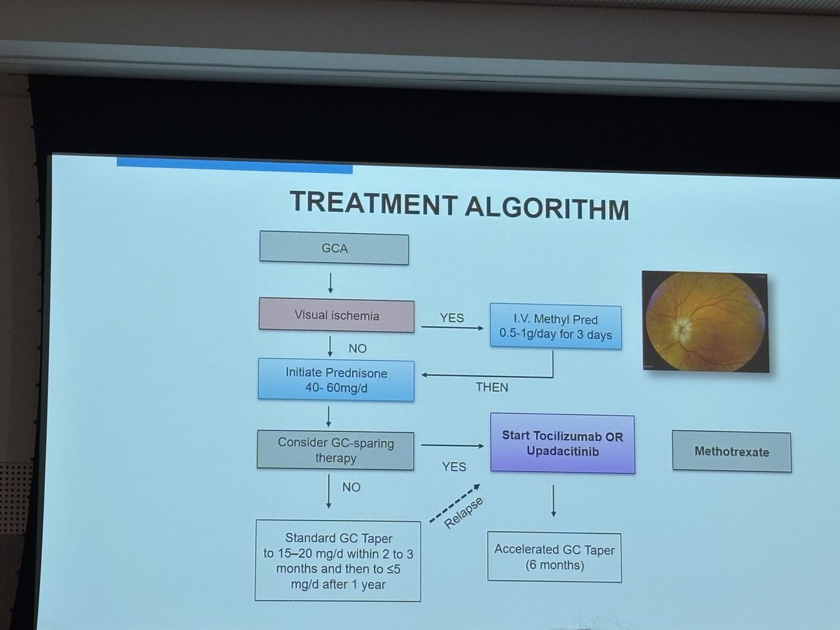 Treatment algorithm of Giant Cell Arteritis:
⁦<a href="/anzvasc/">ANZ Vasculitis Society, '26 Vasculitis Wkshop host</a>⁩ #IVW2026 ⁦<a href="/DrAkhilX/">Dr. Akhil 🇮🇳</a>⁩ ⁦<a href="/IhabFathiSulima/">Dr Ihab Suliman</a>⁩ #MedTwitter