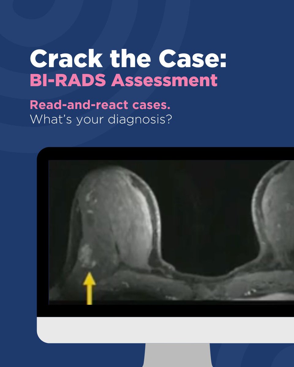 Society of Breast Imaging tweet media