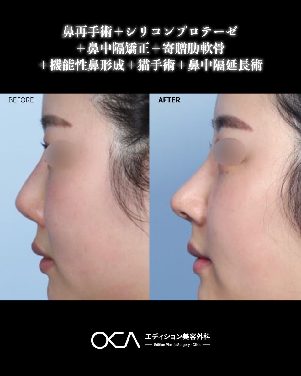 【公式】韓国エディション美容外科 tweet media