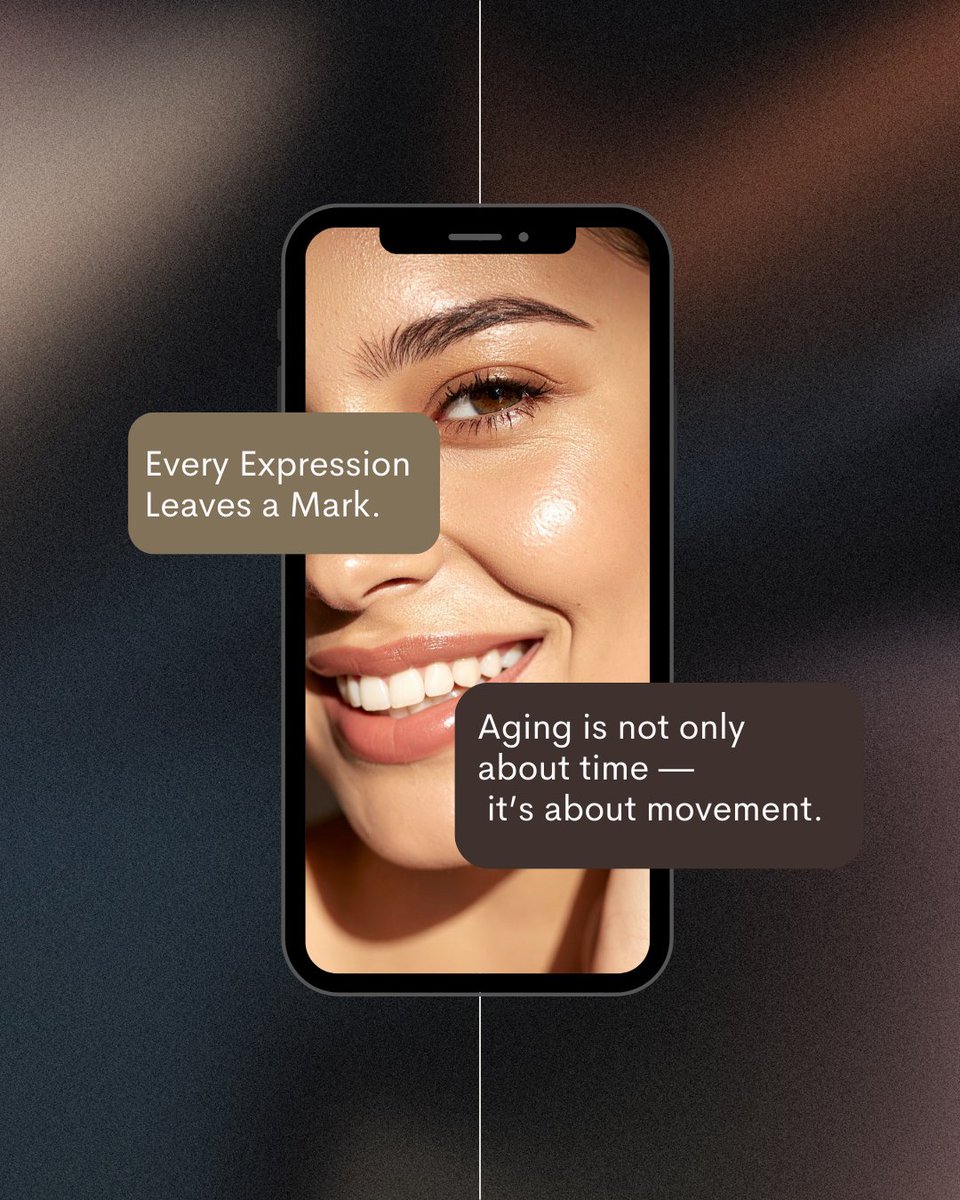 mirpharmakorea's tweet image. Expression lines are shaped by movement over time.

Understanding how they form is the first step toward refined aesthetic care.

#MedicalAesthetics #AestheticPractice #ExpressionLines