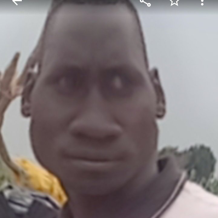 With this kind head , u no pity me 🥲😬 follow for follow abeg 🥲🥲