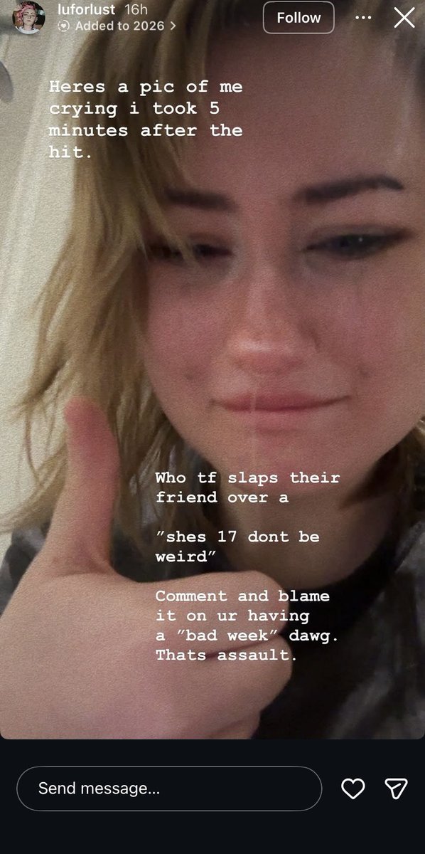 slap deserve ur 22 u rlly shldnt be weird with a 17 yr old 
u rlly is back on ur bllshit with the maker assaulting u shit he really is ur matt 2.0 hope he do not date someone and u harass them 2 
know wha else is assault? choking ppl and doing sexual shit when not consented to