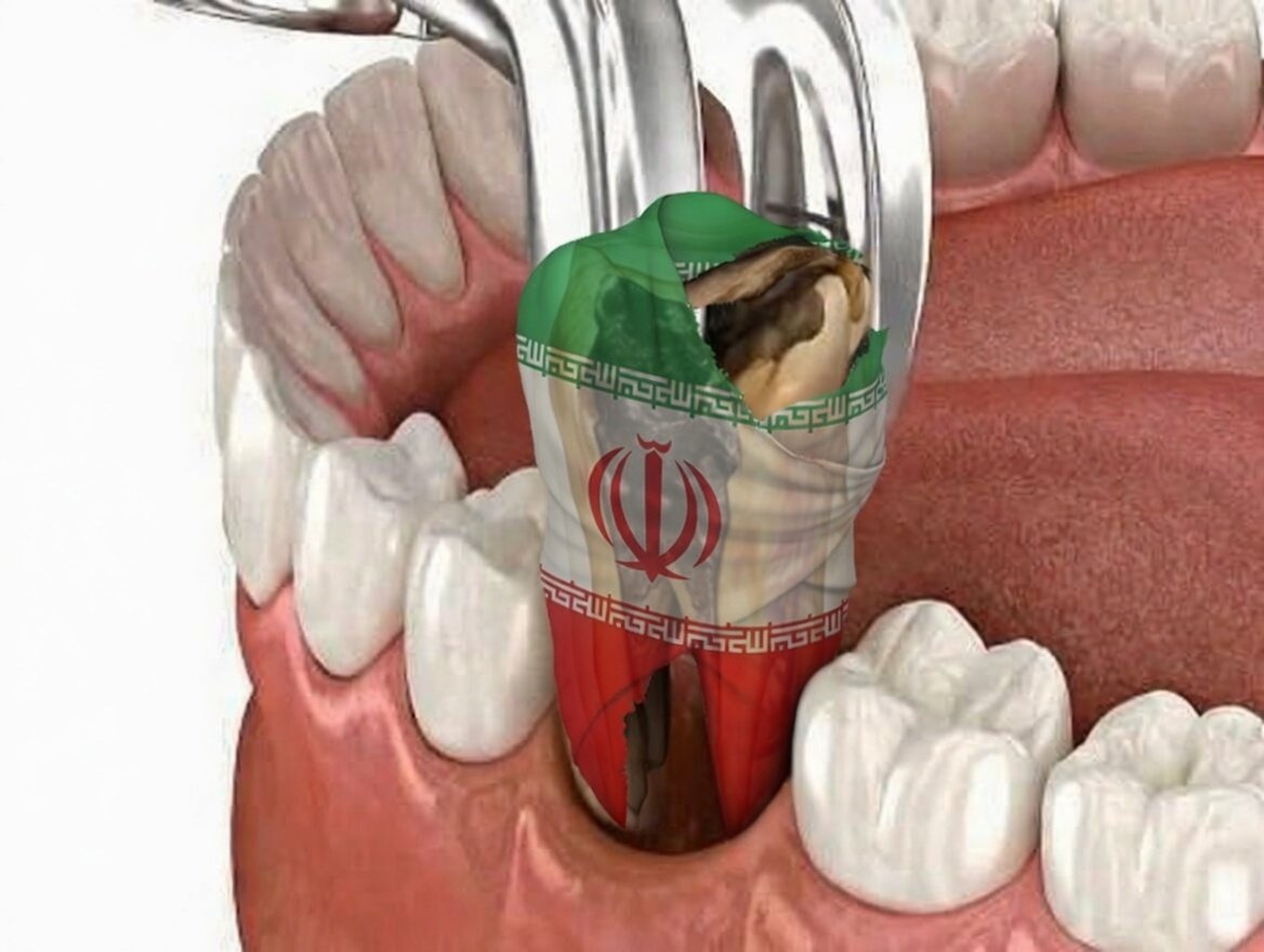MOSSAD COMMENTARY:
🦷 THE “PULLING THE TOOTH” THEORY

Here’s a simple idea.
When you have a rotten tooth, you know it has to come out.
But you delay.

Why?
Because you’re afraid of the pain. The cost. The moment of impact.

So you wait.
And wait.
And wait.

But the pain doesn’t