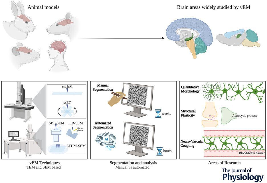 JPhysiol's tweet image. Vanessa Chiappini (@unito) and co-authors present this scoping review into ultrastructure of #astrocytes using volume electron #microscopy 📜 🔬 

🔗 Read the paper: buff.ly/3KvTqP4