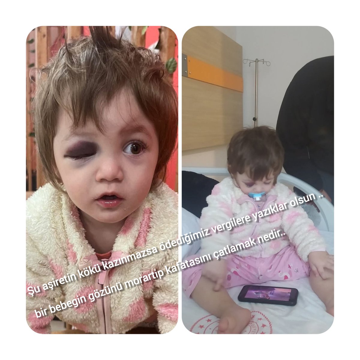 CihanCebeci19's tweet photo. Bakın şu görüntüye ve yüreğiniz dayanmasın.Normalleşmesin bu durum.
Şu aşiretin kökü kazınmazsa ödediğimiz vergilere yazıklar olsun .. bir bebegin gözünü morartip kafatasını çatlamak nedir..
#Yalova https://t.co/4wzQhKAjsQ